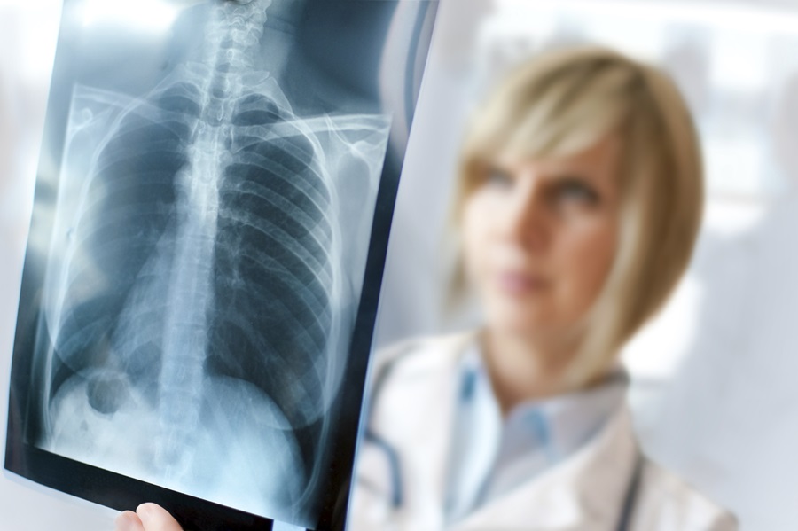 Health care provider reviewing a chest x-ray