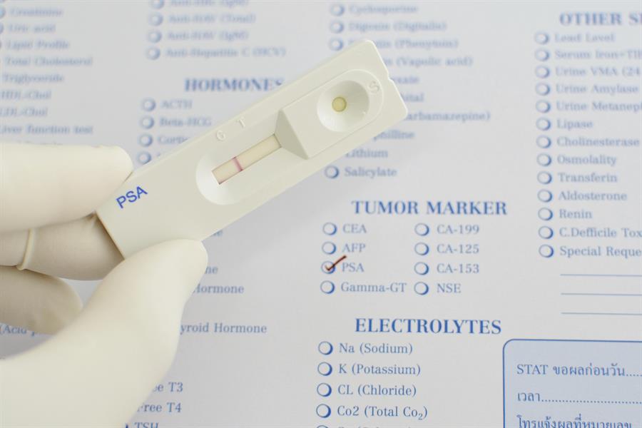 Hand with medical glove on holding a white plastic PSA test stick